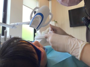 201608 1042 井川歯科のホワイトニングの実際 薬剤塗布 (3)