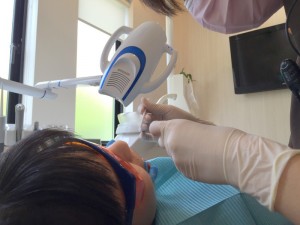 201608 1042 井川歯科のホワイトニングの実際 薬剤塗布 (4)