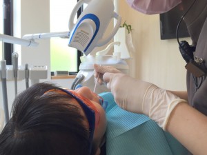 201608 1042 井川歯科のホワイトニングの実際 薬剤塗布 (1)